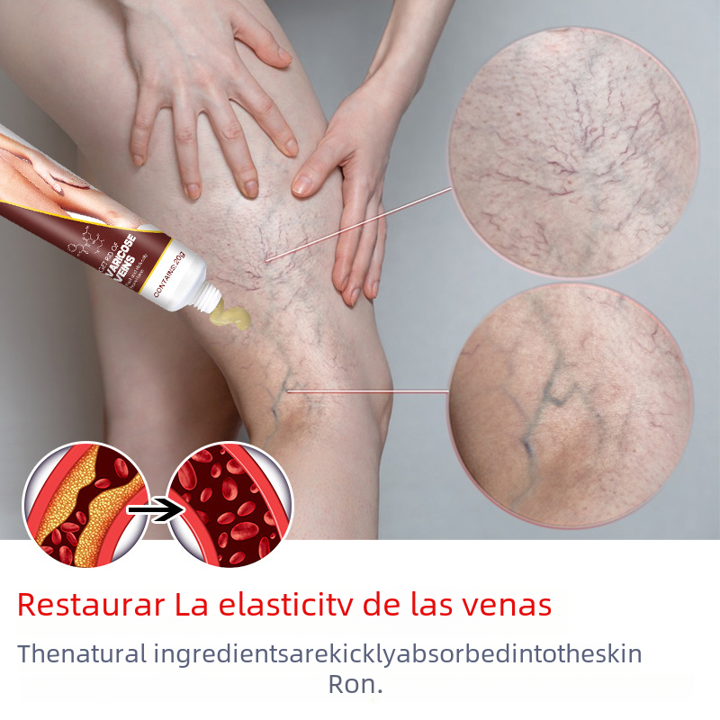 Crème veineuse pour la circulation des jambes