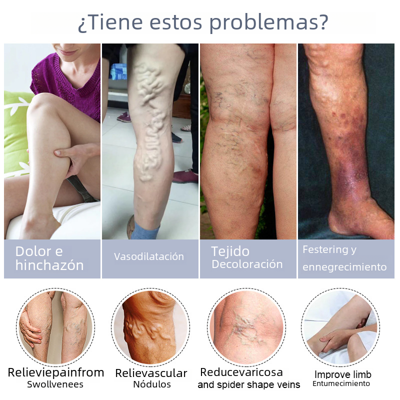 Crème veineuse pour la circulation des jambes