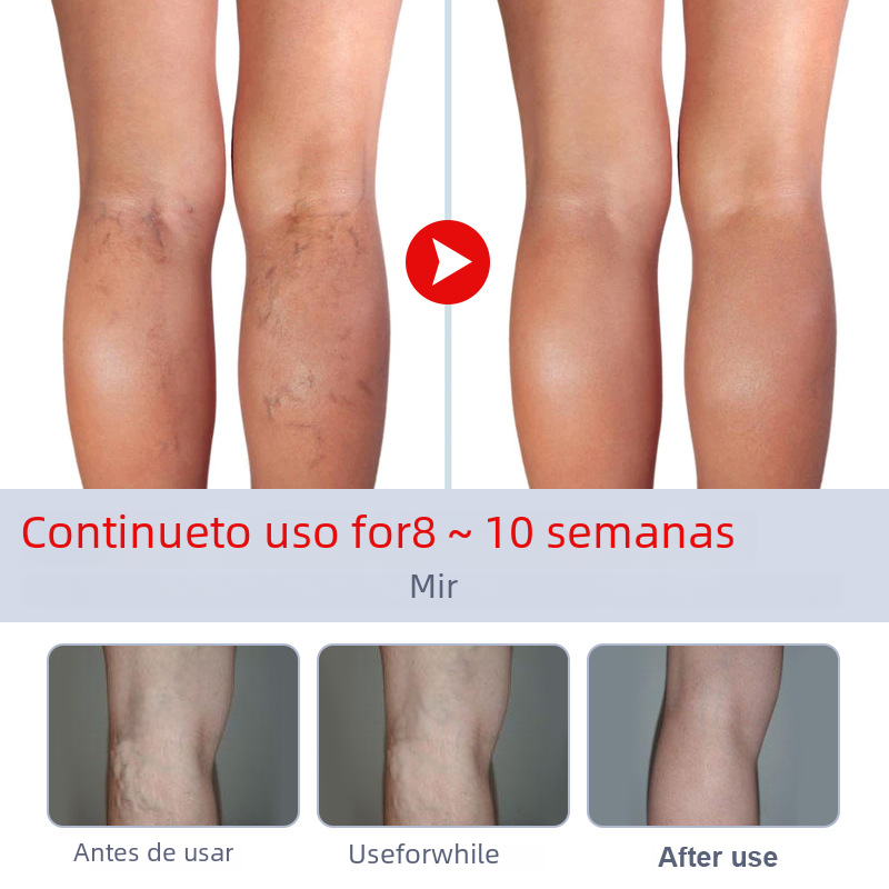 Crème veineuse pour la circulation des jambes